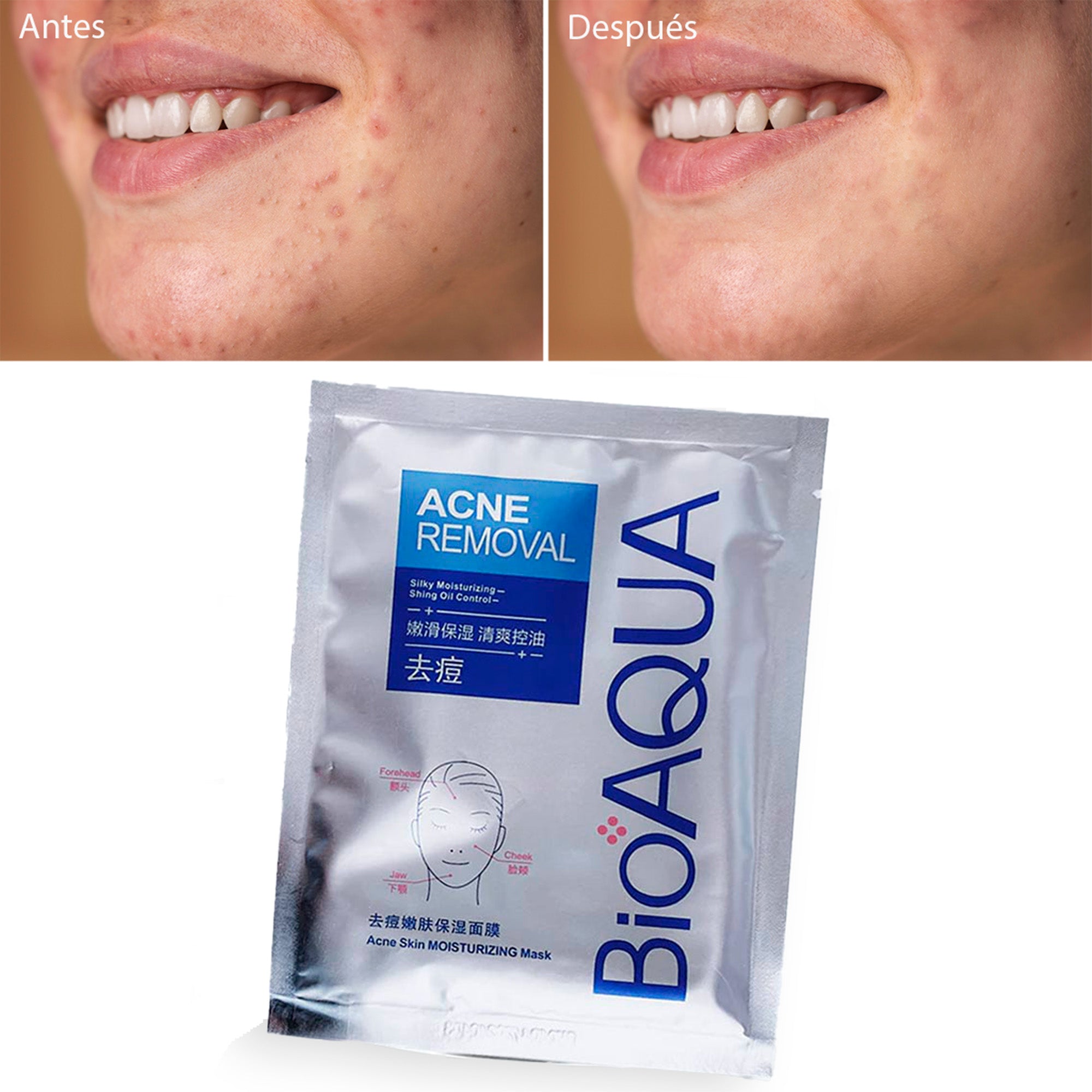 Mascara De Velo Anti Acne