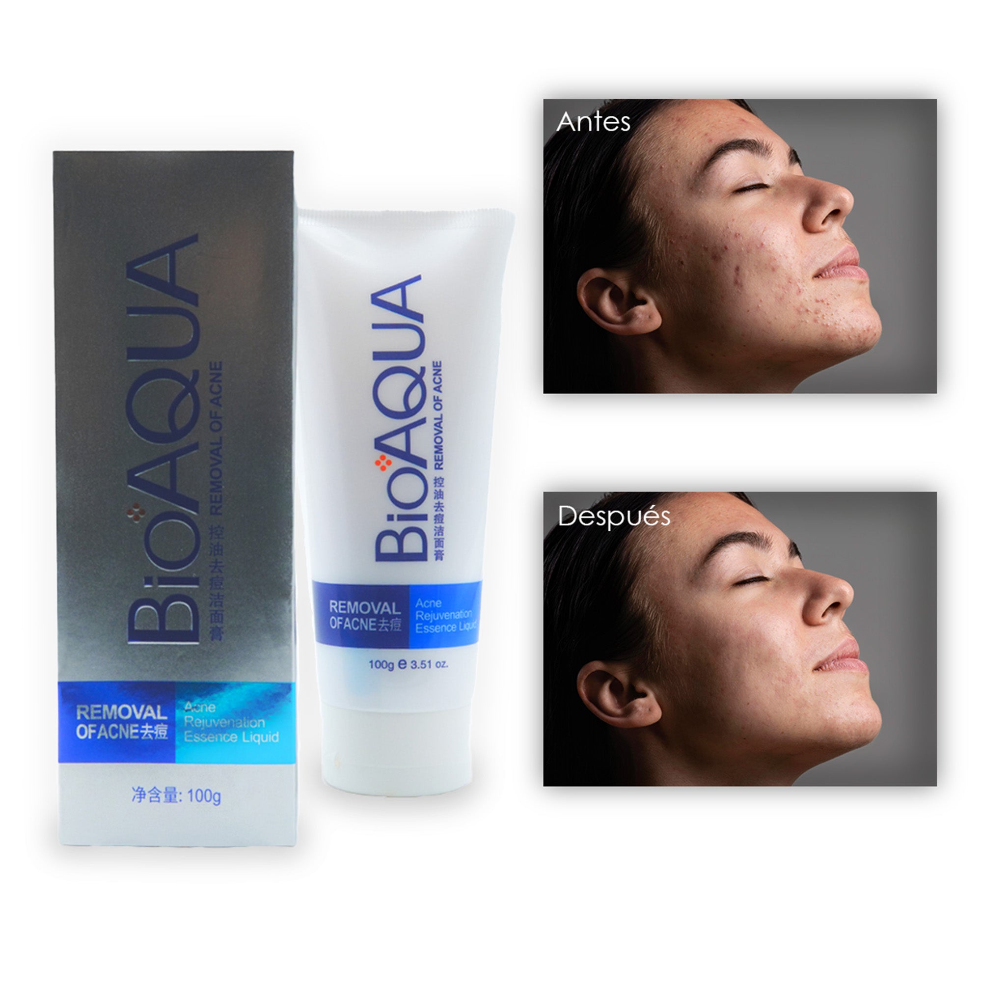 Jabon Anti Acne