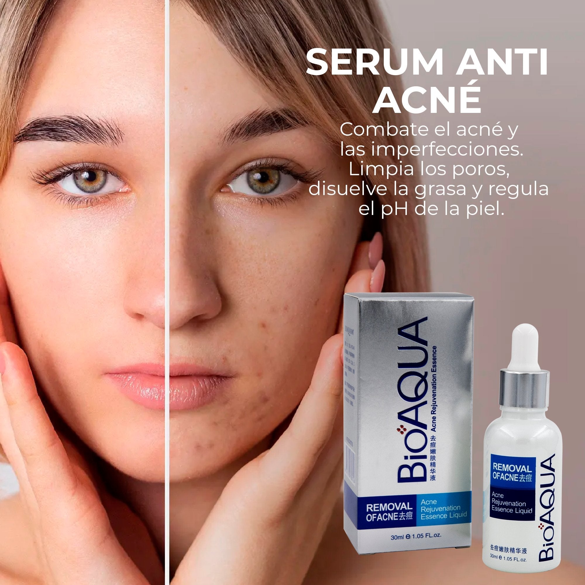 Serum anti acne